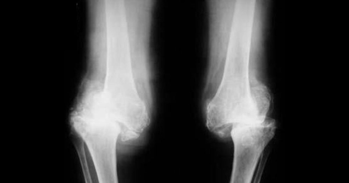 Diagnose The Condition From The Image