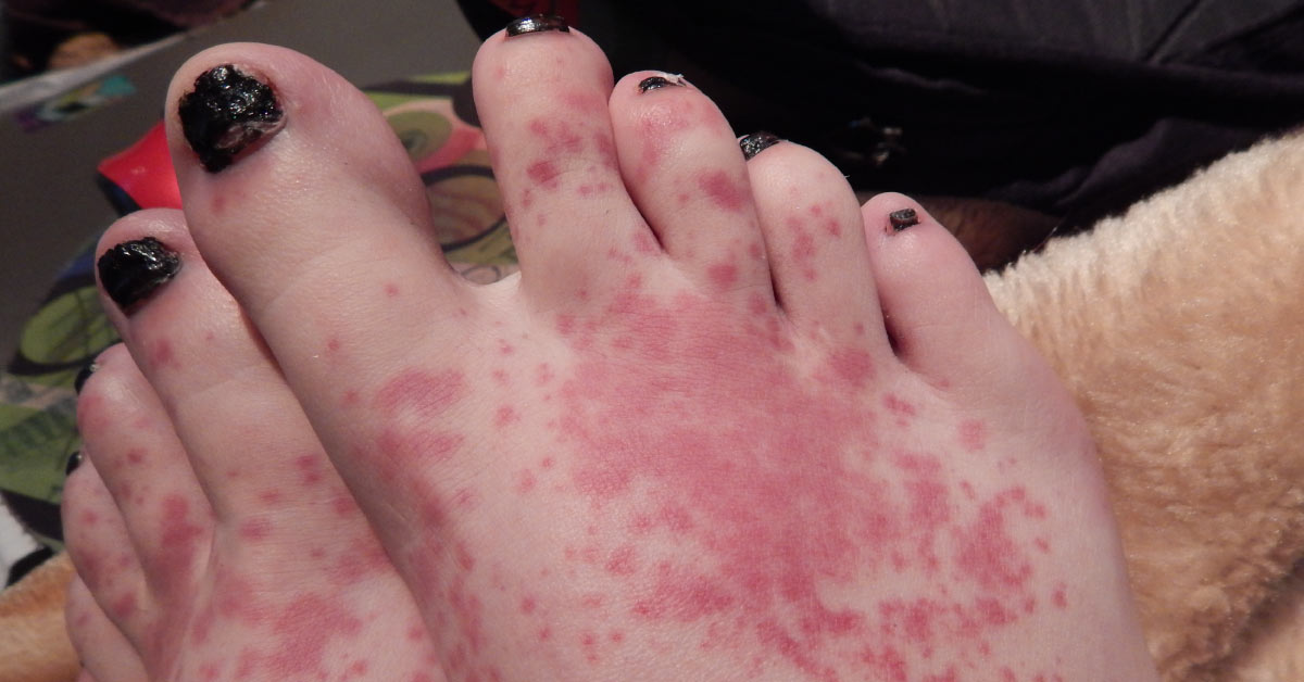Spot The Condition
