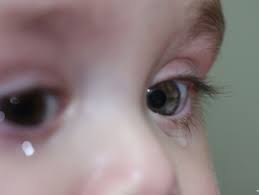 Ocular Manifestations Of Lead Poisoining