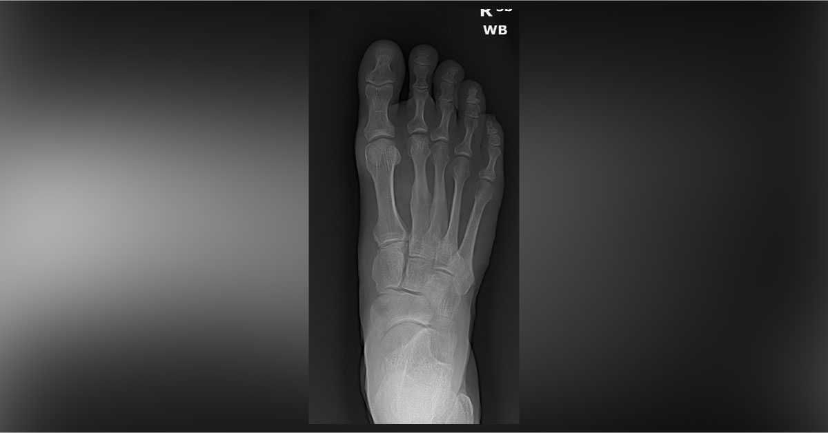 Spot This Underlying Condition