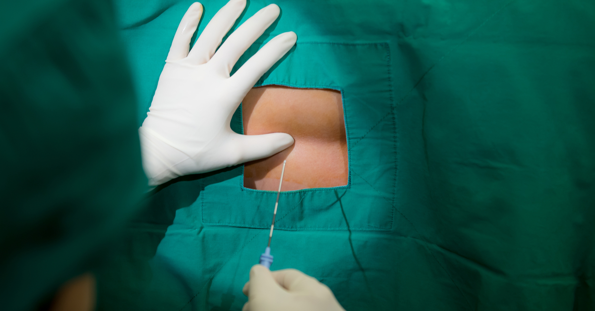 Which Position Better For Spinal Anesthesia: Sitting Or Lateral?