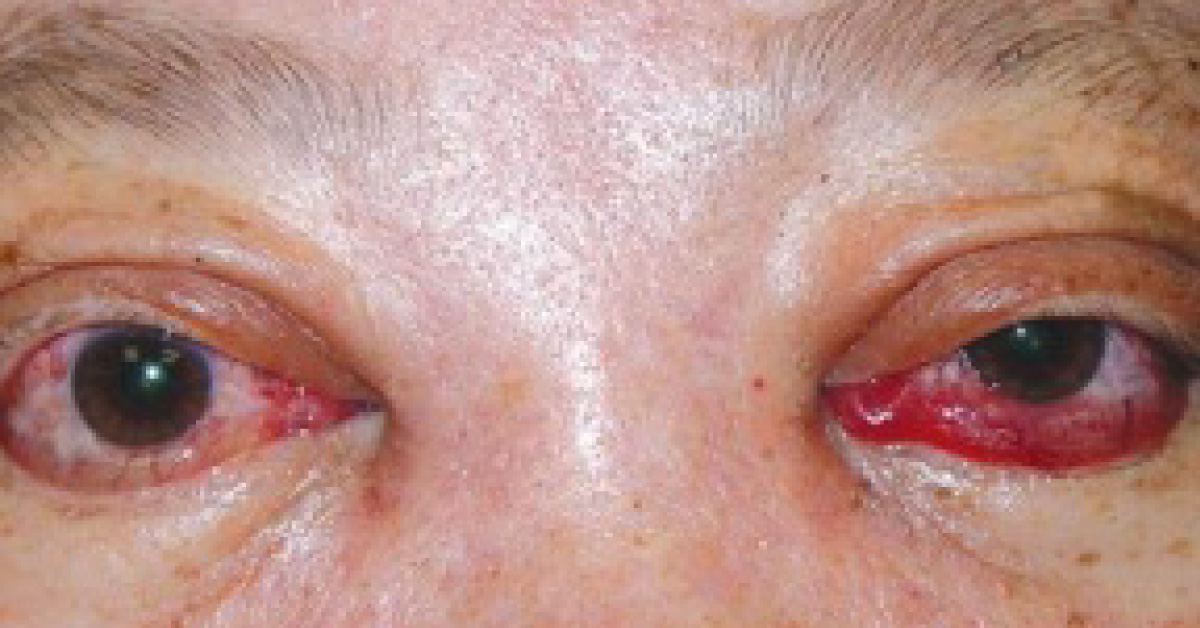Image based diagnosis