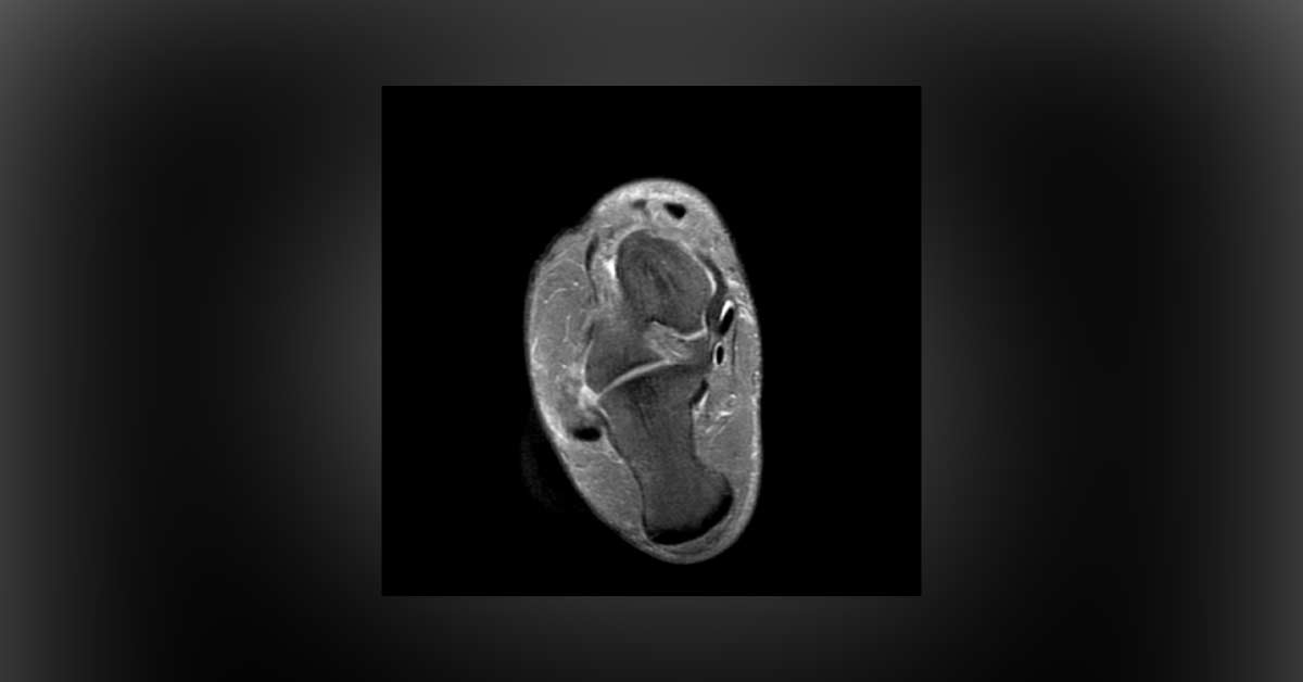 Female With Ankle Pain And Swelling