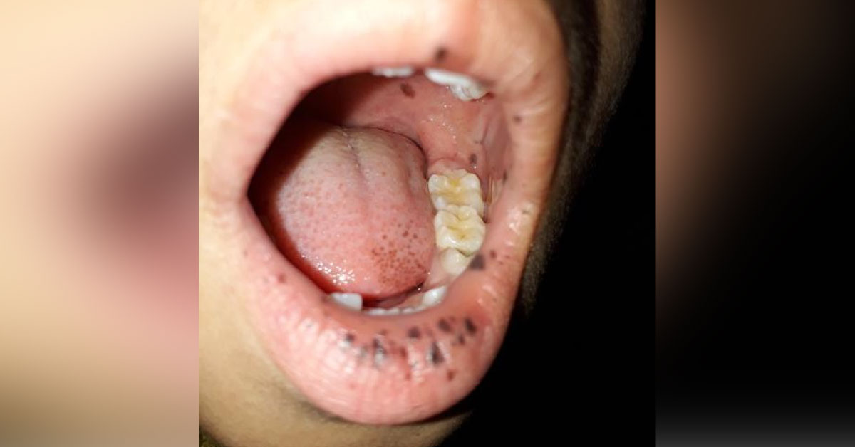 Diagnose The Derma Condition Since Birth