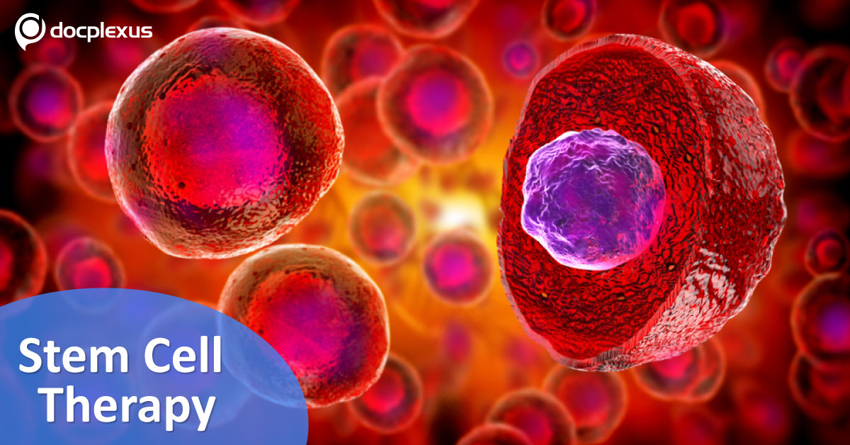 Stem Cell Therapy: A Promising Approach For Improved Vision