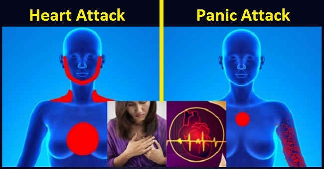 How To Recognize The Difference Between A Panic Attack And Heart Attack?