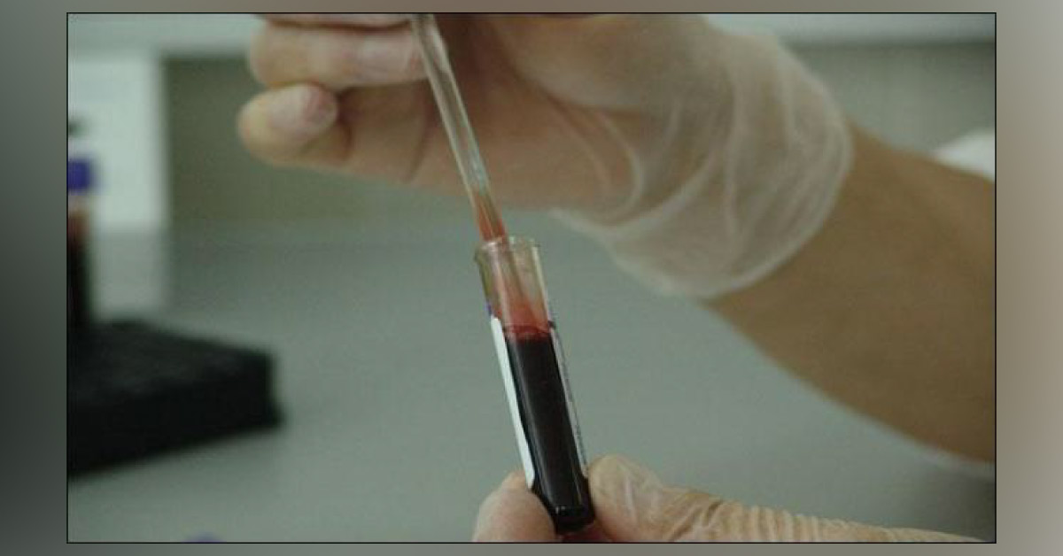 Blood Test To Diagnose Two Cancer Types Is Here