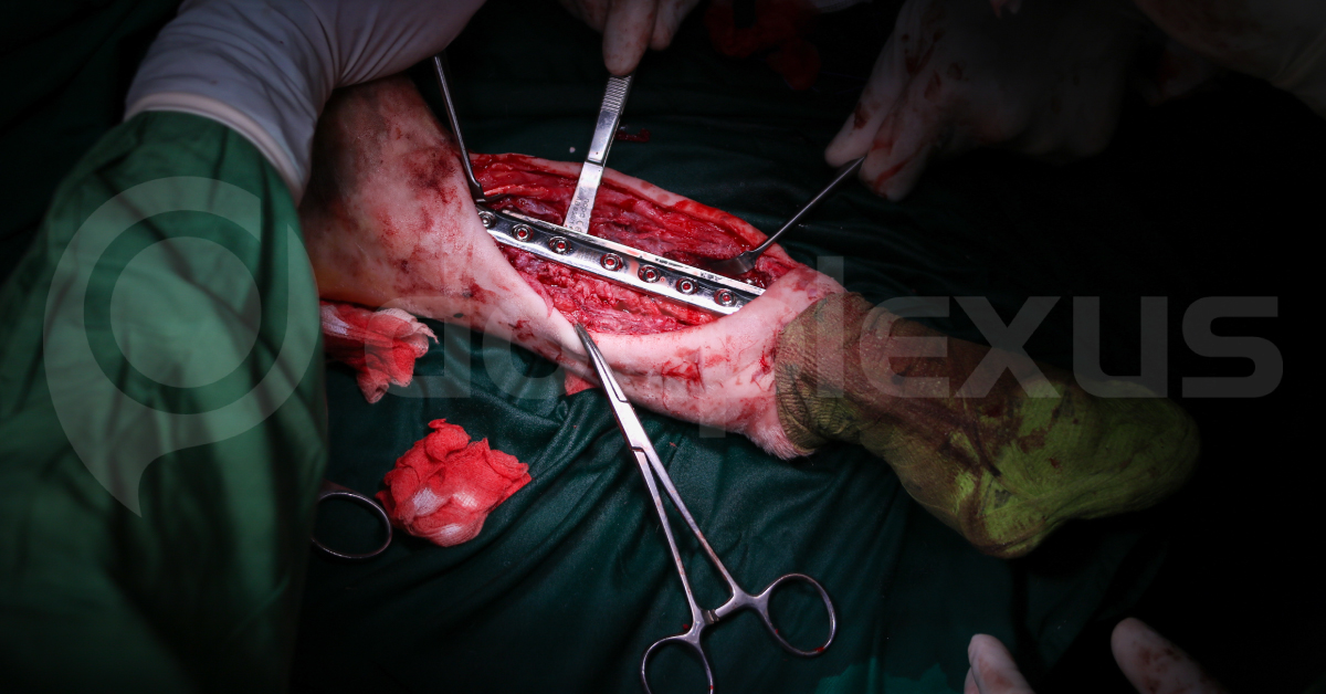 Is Antibiotic Prophylaxis Useful In Preventing Infection After Implant Removal?