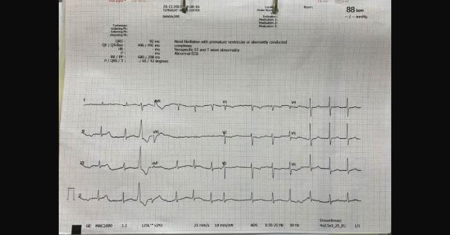 Diagnose The ECG