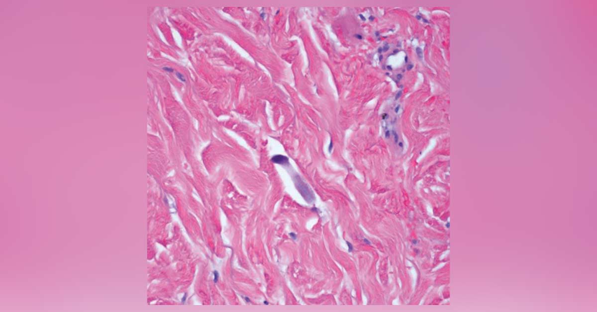 Spot This Condition
