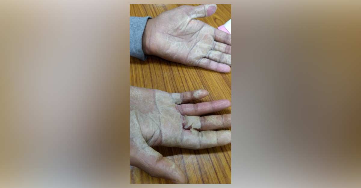 What Can Be The Diagnosis For This Patient?