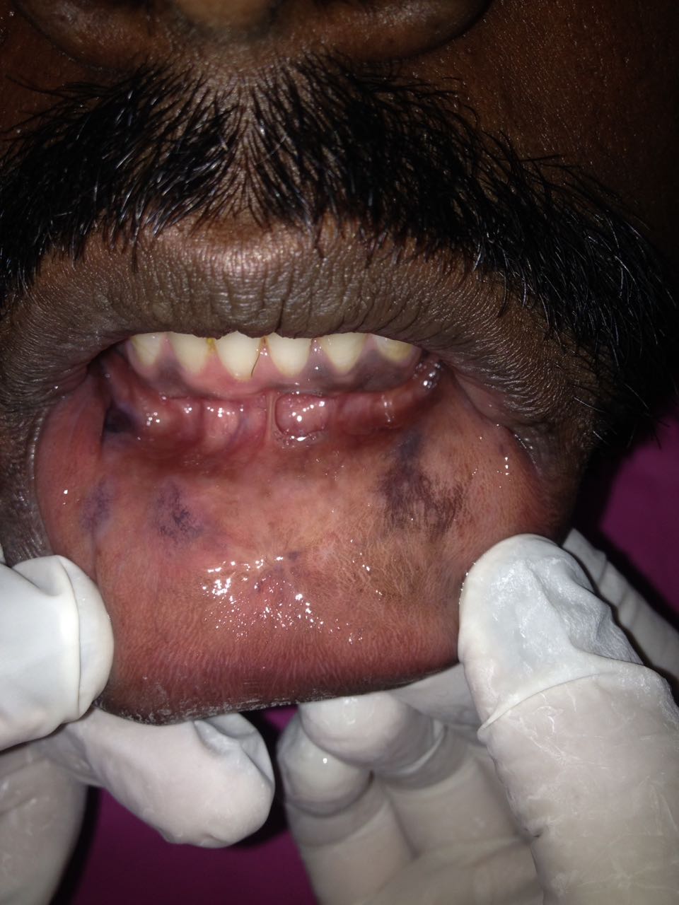 What Could This Pigmentation Be?