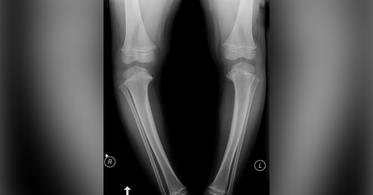 Identify The Underlying Condition