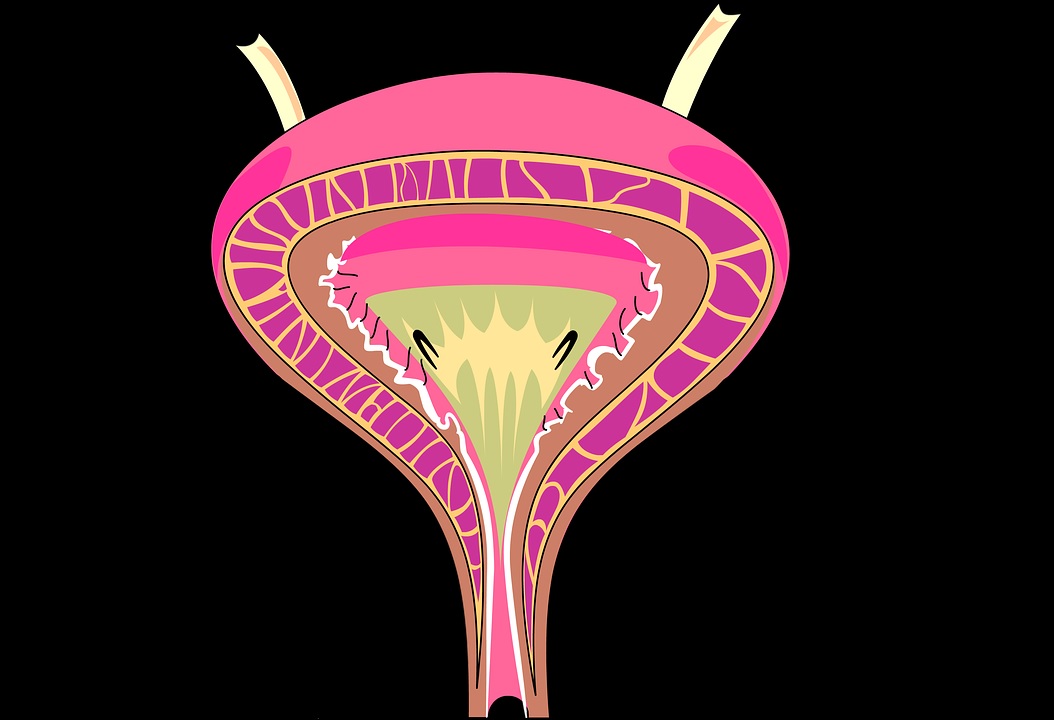 Superficial Bladder Cancer: Management with ESIC