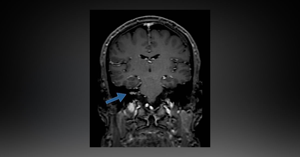 What Do These Findings Reveal?