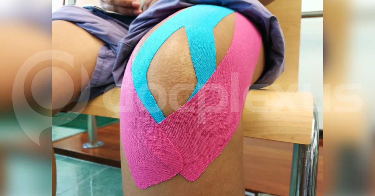 Anterior Cruciate Ligament Reconstruction: British Orthopedic Association