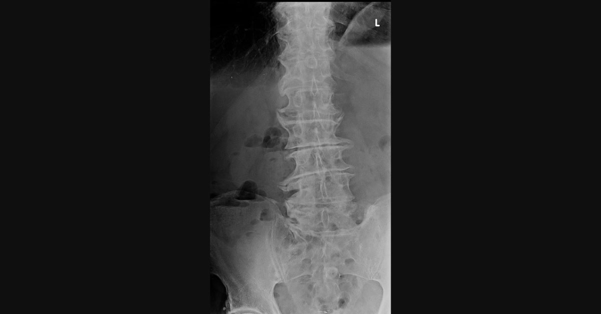 Solve This Orthopedic Case