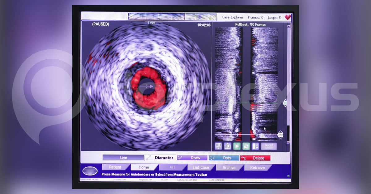 Clinical Utility Of IVUS versus OCT In Cardiovascular Imaging