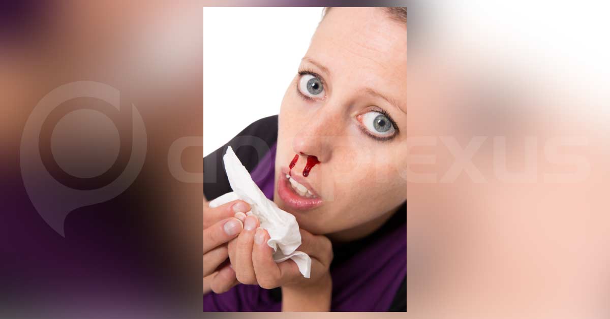 Epistaxis Management: Topical Tranexamic Acid Or Nasal Packing?