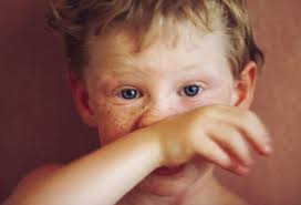 Ocular Manifestations Of Mumps A Brief Review