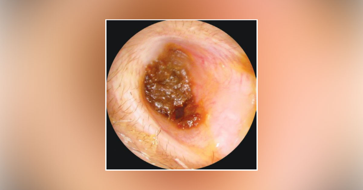What Does This Endoscope Reveal?