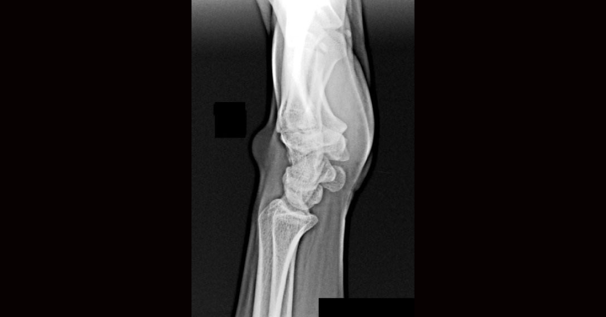 A Woman With Lump On The Wrist