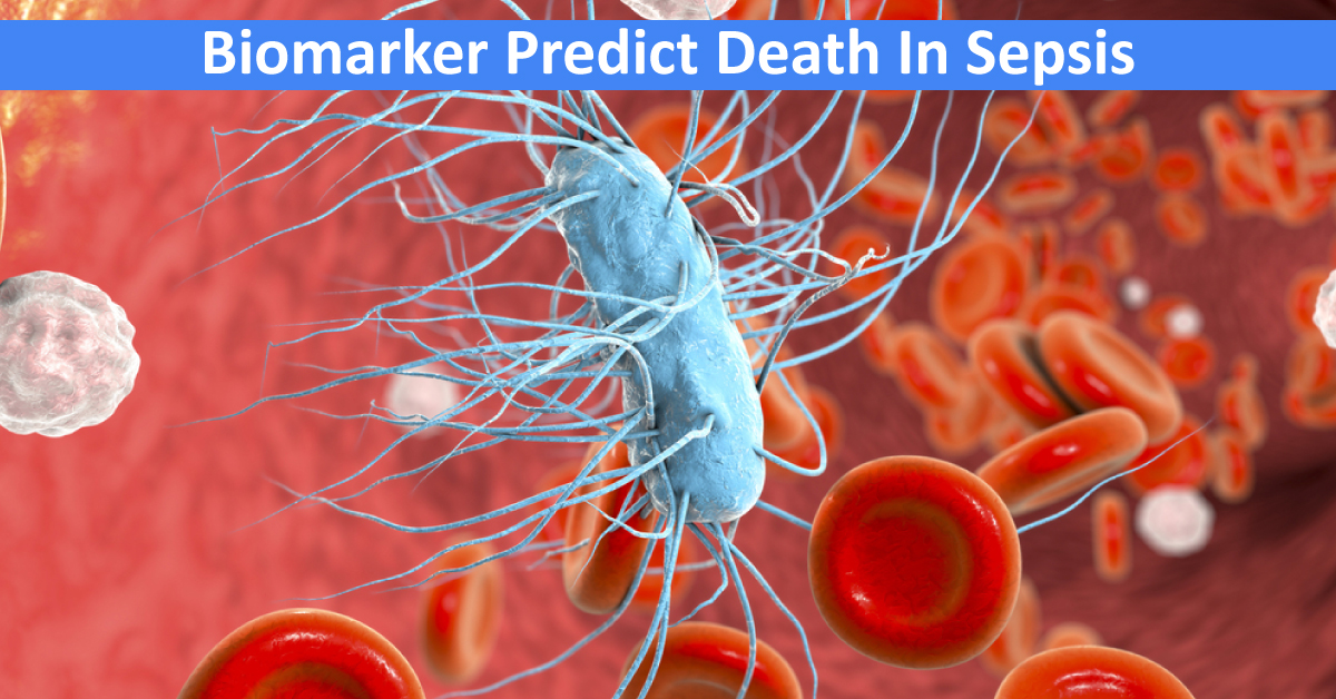 Biomarker Predicts Death In Sepsis