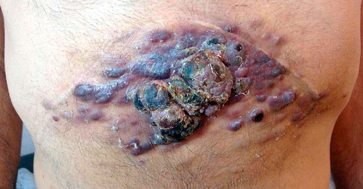 Identify The Condition