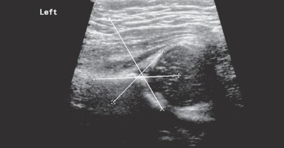 Identify The Ultrasound Image