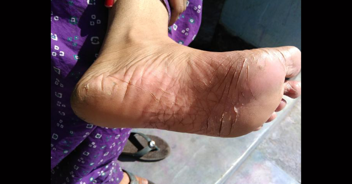 Diagnosis And Management Of This Condition