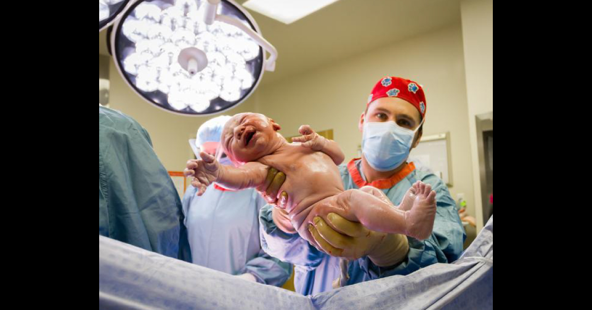 Evolution Of Raising Caesarean Section Rates