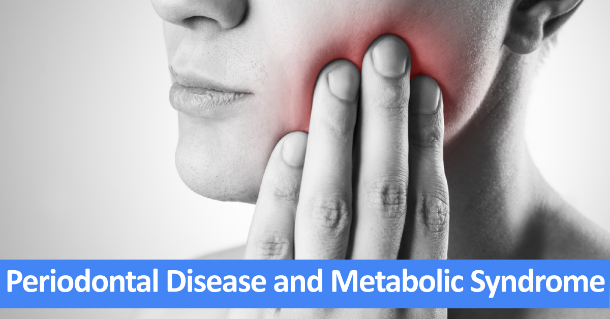 Periodontitis Associated With Metabolic Syndrome