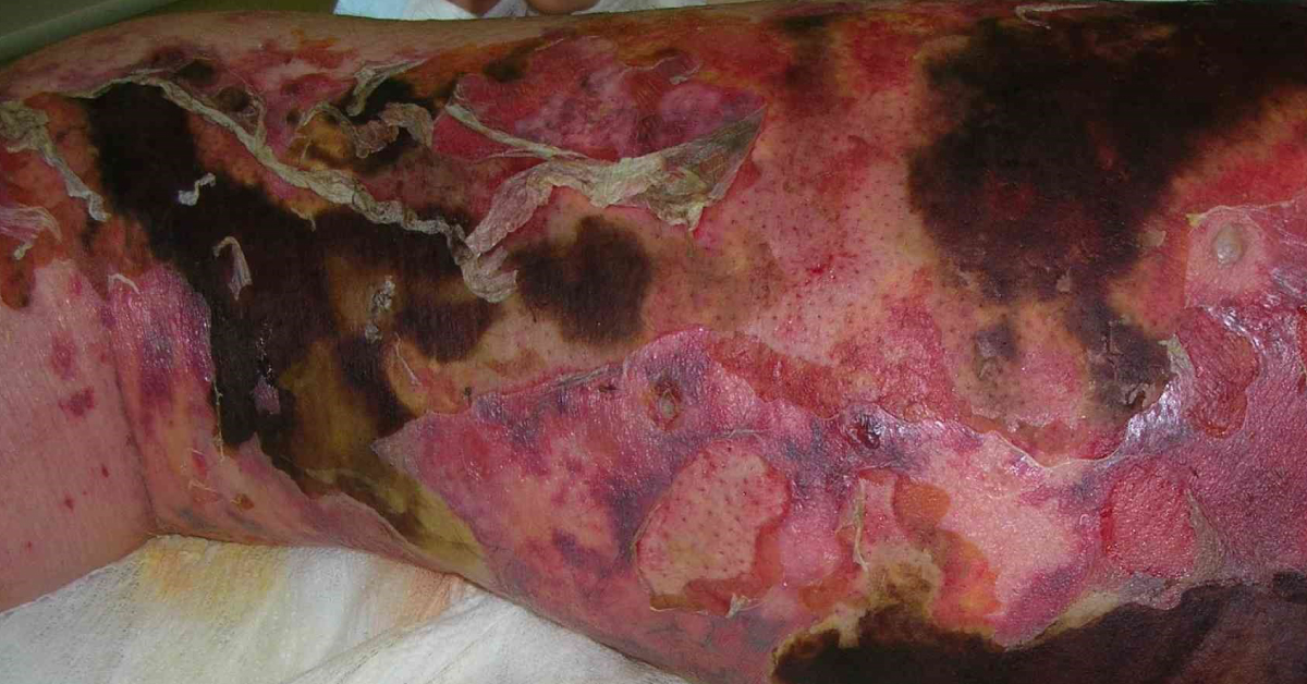 Spot the condition