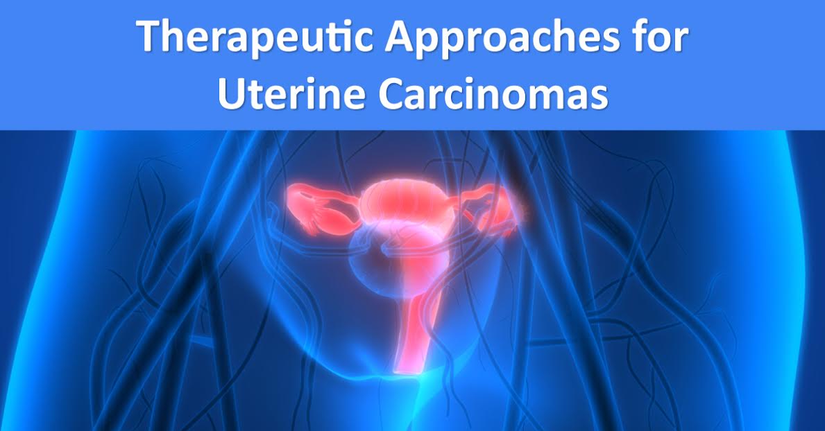 Therapeutic Approaches For Uterine Carcinosarcomas