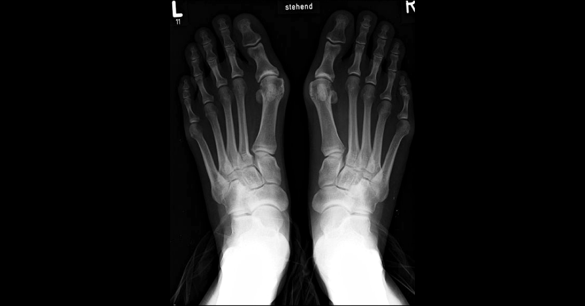 Identify The Abnormality
