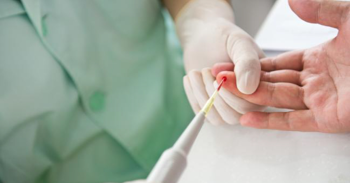 Detecting And Monitoring A Patients Cancer By A Simple Blood Test