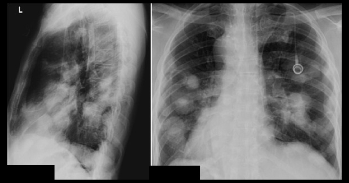 Conclude This Patient Case