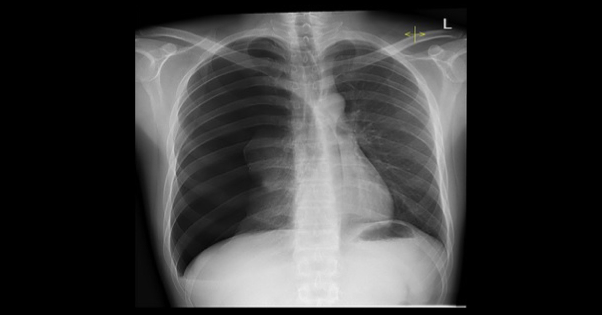Spot The Abnormality From The Radiograph