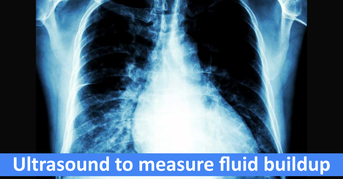 Noninvasive Ultrasound To Measure Lung Buildup