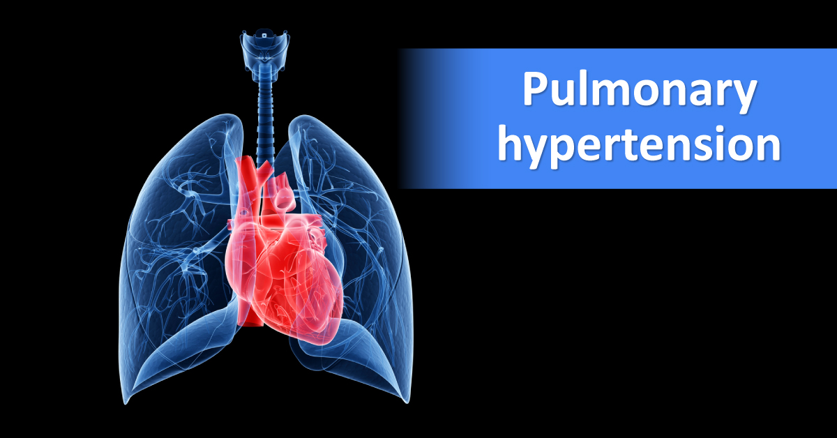 New Treatment Strategies for Pulmonary Hypertension