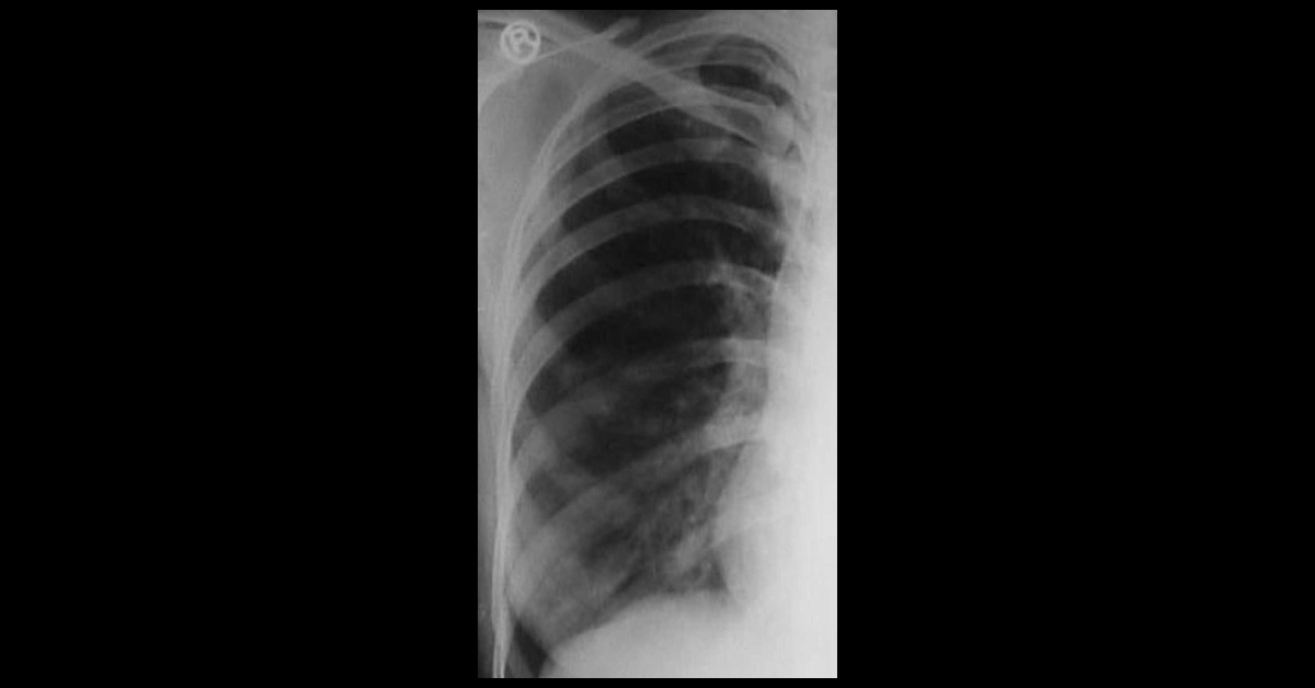 Identify The Condition