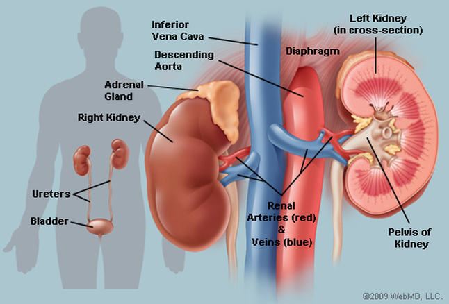Kidney Diseases Are On Rise, Few Measures To Prevent It
