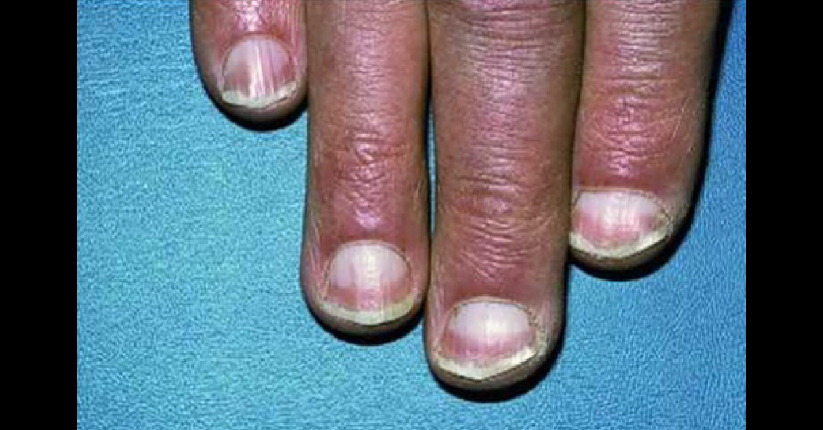 Identify This Condition