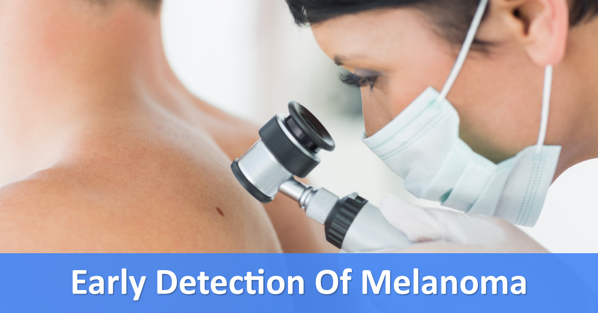 Dermatologist Play A Major Role In Early Diagnosis Of Melanoma