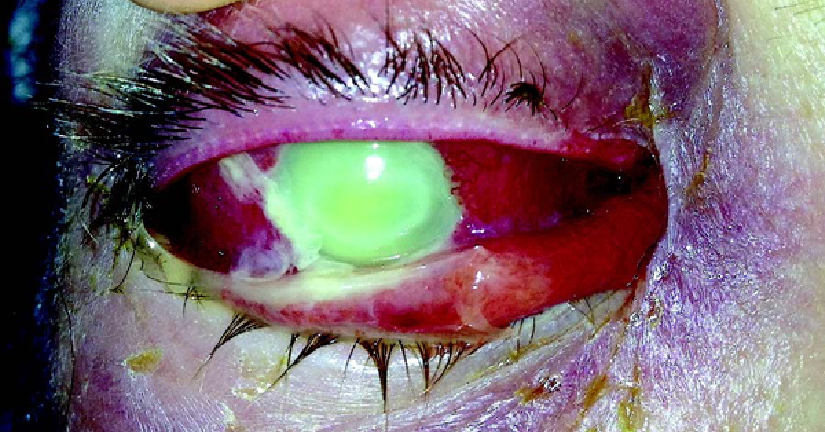 Identify The Cause Of Red Eye