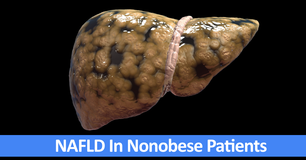 NAFLD in a Nonobese Patient