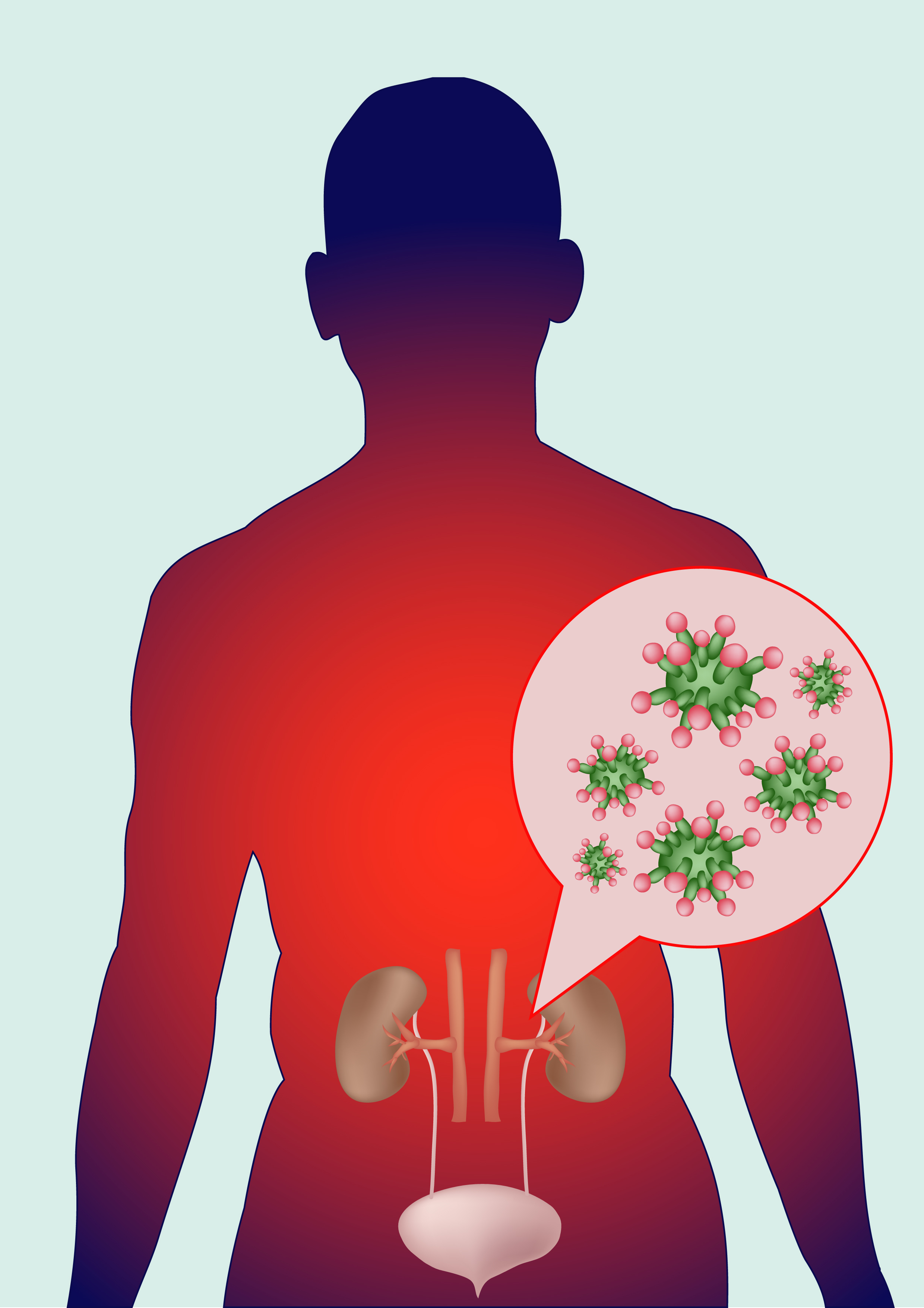 Urinary Tract Infection, An Ideal Therapeutic Approach
