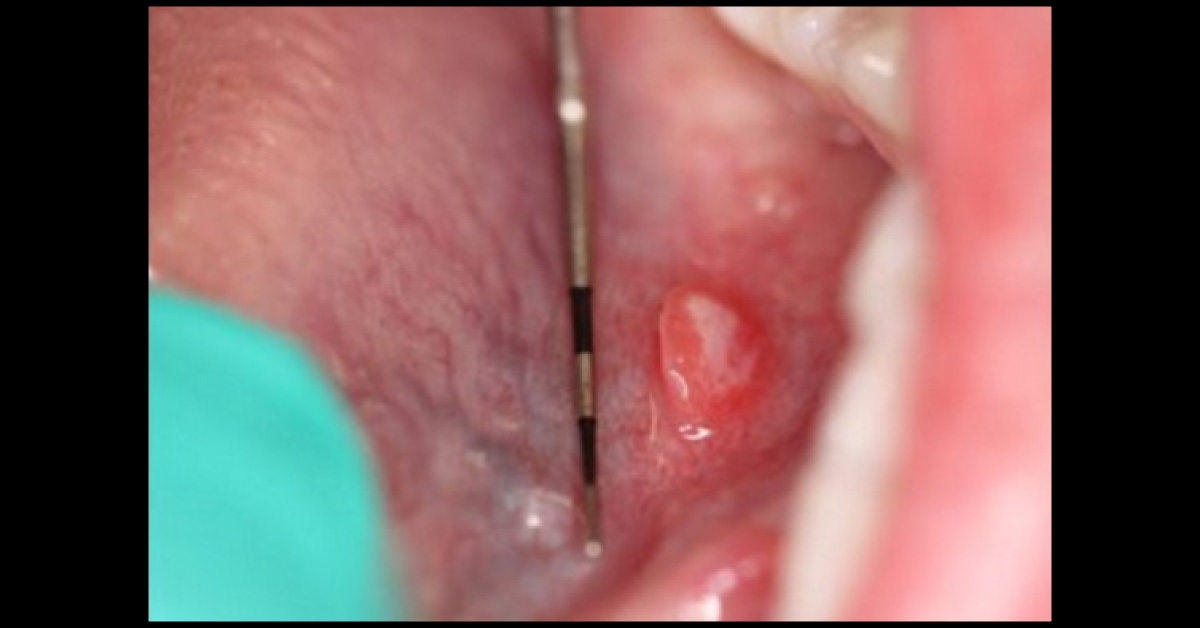 Dental Presentation Of A Young Girl