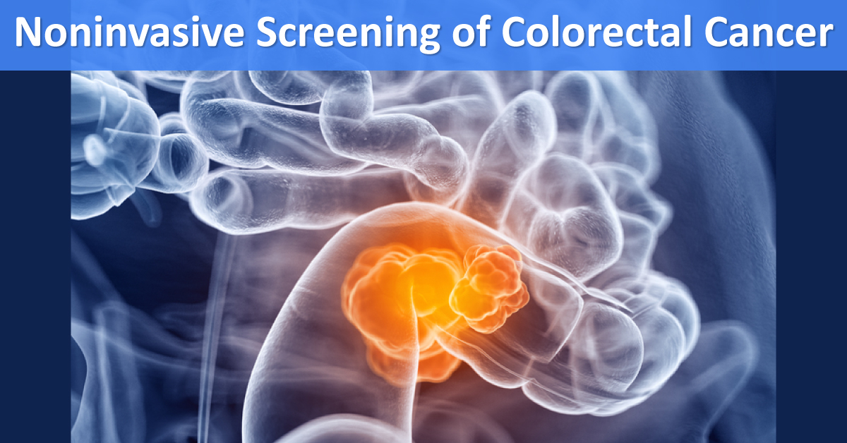 Noninvasive Screening Tests For Colorectal Cancer