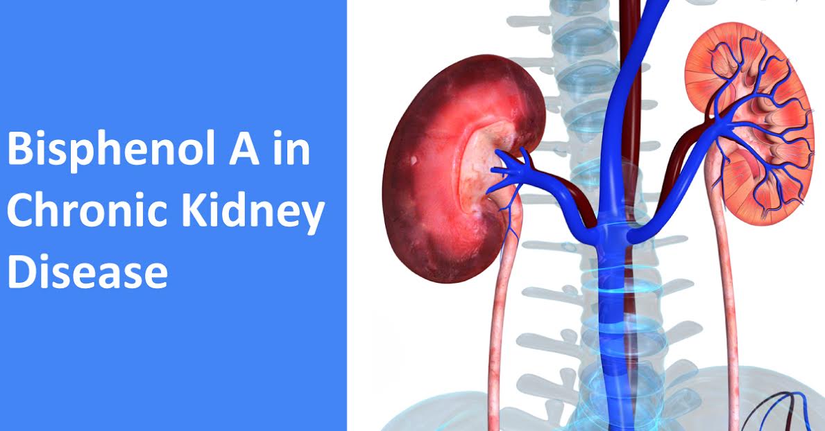 Bisphenol A In Chronic Kidney Disease